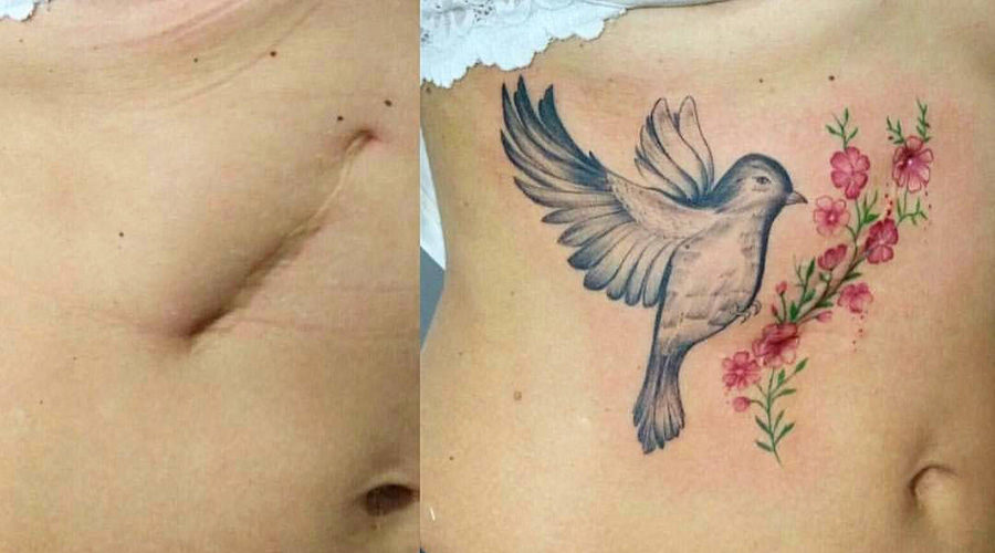 Tatuagem para cobrir cicatriz